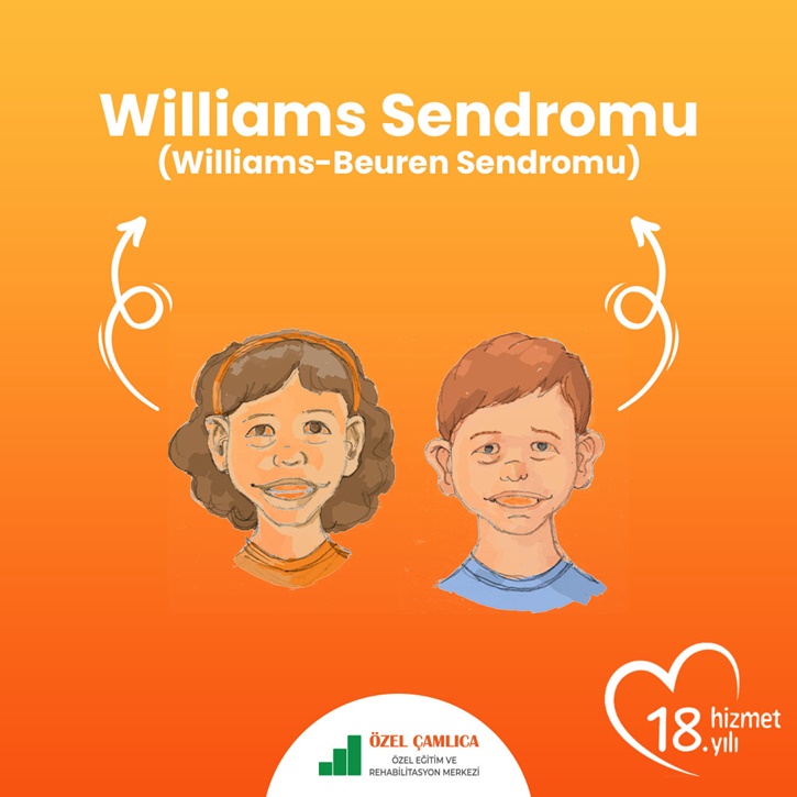 Williams sendromu